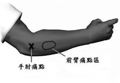 胳膊肘子酸痛怎么办