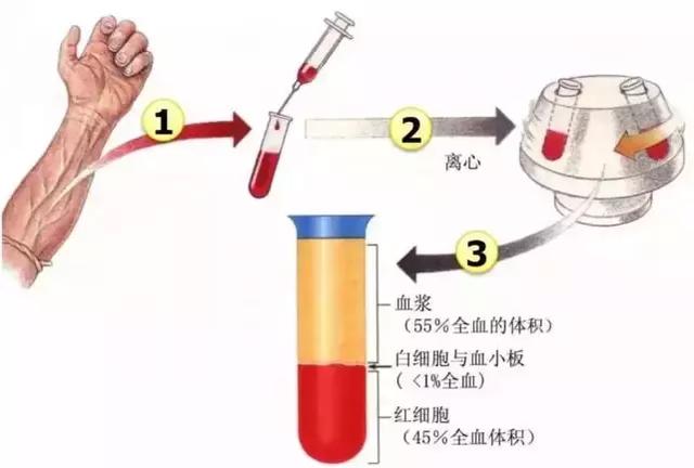 胳膊肘子酸痛怎么办