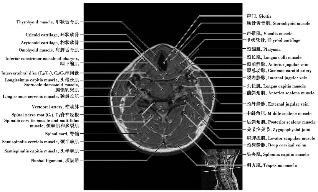 中枢神经系统影像解剖图谱连载2| 颈椎mri概论 t1wi轴位解剖图