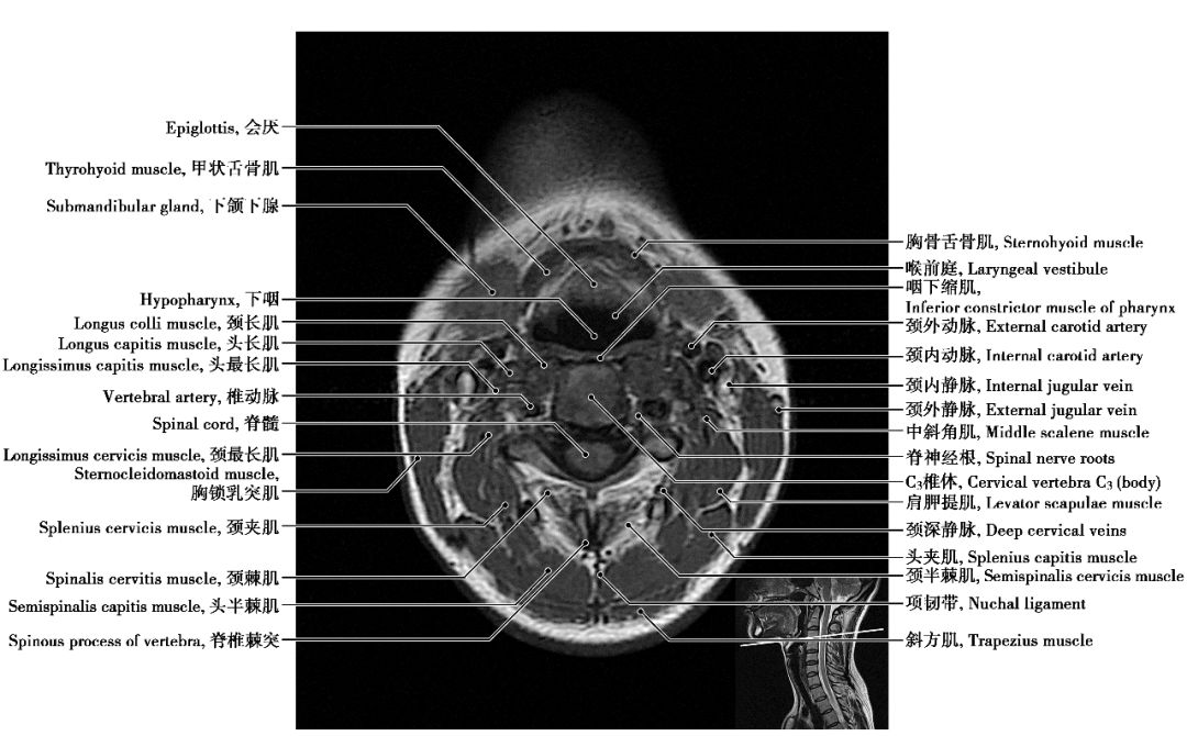 中枢神经系统影像解剖图谱连载2颈椎mri概论t1wi轴位解剖图