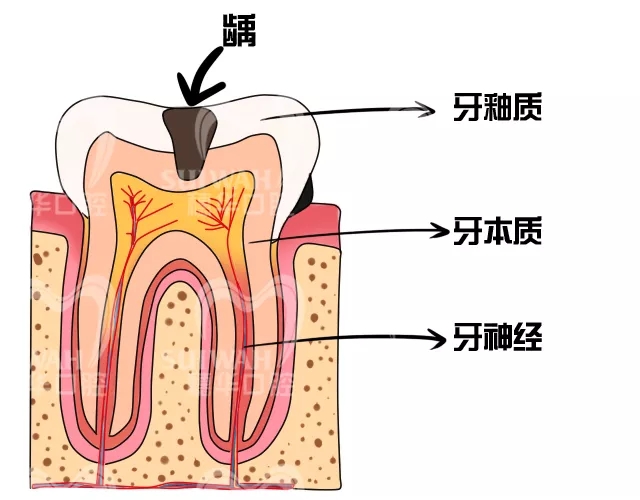 吃雪糕牙疼怎么办