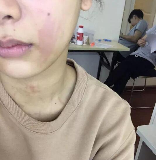 密恐警告!这9个女明星的皮肤真的很差!有人一