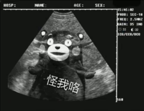 恶搞套路表情包:我怀孕了,你的,你看着办