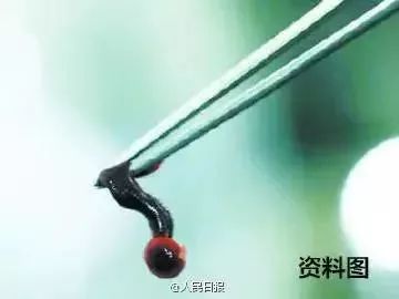                     南宁的家长注意！快看看孩子身上有没有多冒出小黑点，这东西可能会要命！