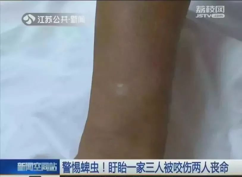                     南宁的家长注意！快看看孩子身上有没有多冒出小黑点，这东西可能会要命！