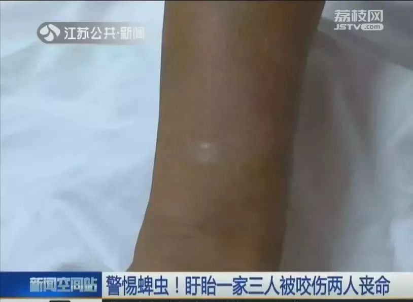                     2岁男孩眼皮上突然冒出一个小黑点！医生：这东西会要命！
