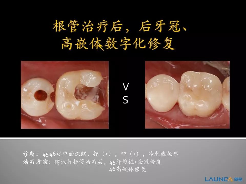 齿间技艺,指尖绽放|第二季 朗呈杯武汉第一口腔医院cad/cam病例大赛