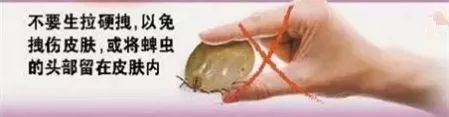                     家长注意了！2岁男孩眼皮上突然多了颗“黑痣”！医生：这东西会要命！