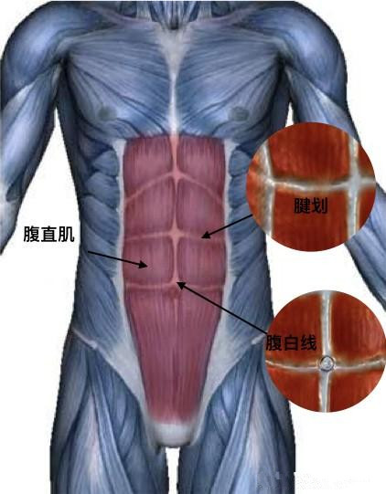                     产后腹直肌分离，肚子松松垮垮——孕期强健腹部肌肉才是关键