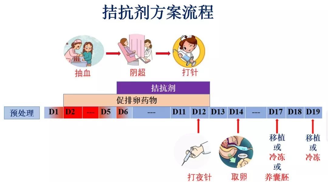 拮抗剂方案是什么流程?