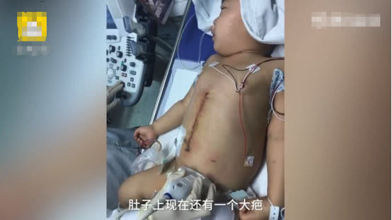                     4岁男童患瘤后切除左肝，半年后又患上白血病，父母称决不放弃