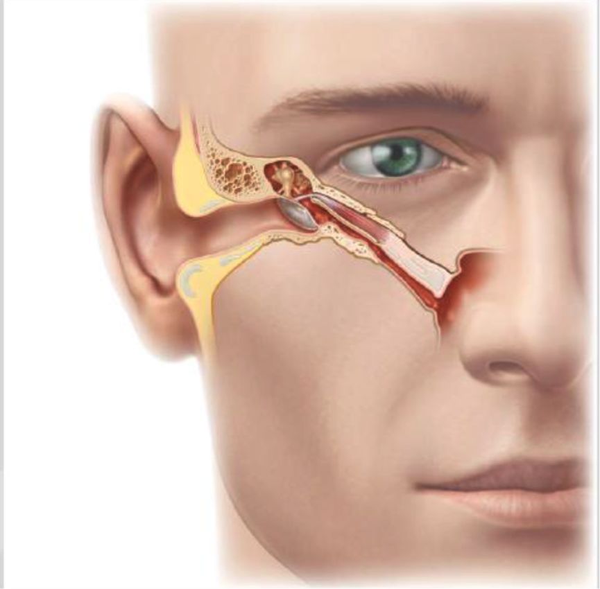 重要的解剖结构,它的一端进入中耳鼓室,另一端则进入鼻子后部的鼻咽部