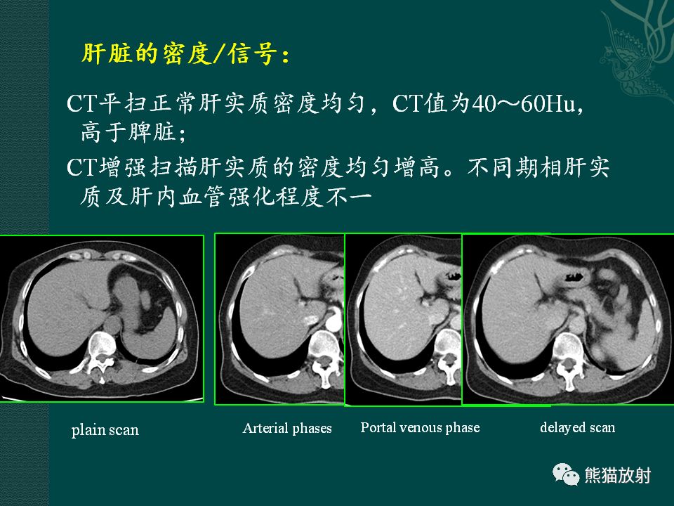 肝脏常见病变丨ct及mri诊断