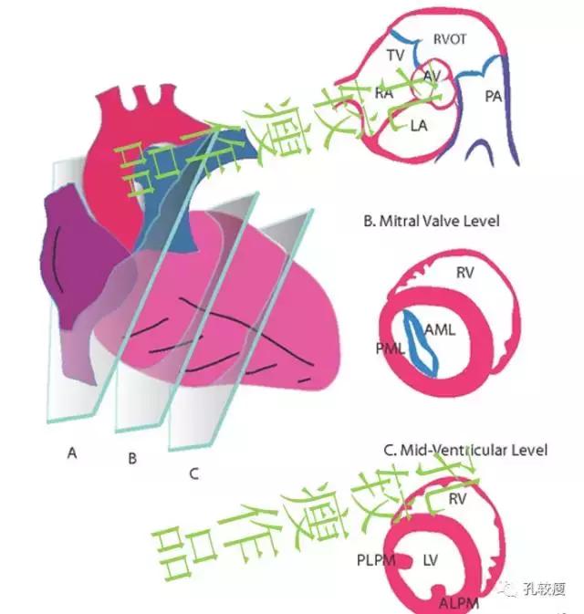 一文读懂心脏超声基本切面
