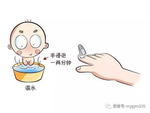 【MYMO课堂】宝宝手指上长倒刺是什么原因呢