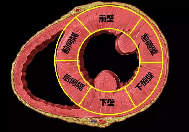 心电图与心脏超声里面的"正后壁"究竟指的哪个位置?