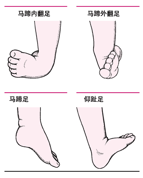                     怀孕后，多久能查出“胎儿骨骼畸形”？过了这一周，孕妈妈才放心