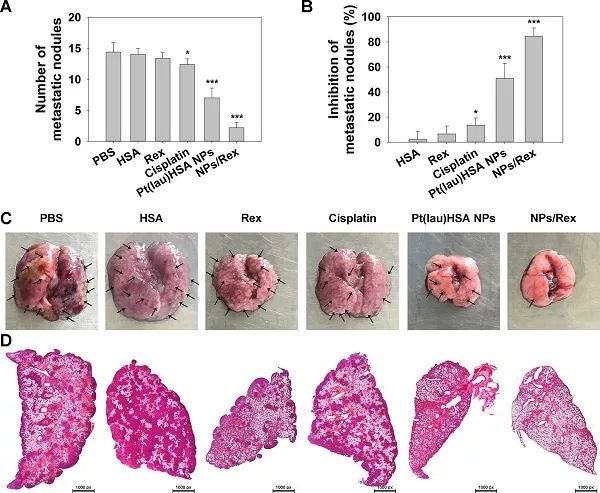报道 生物外泌体驱动对接纳米颗粒对原位乳腺癌肺转移的特异性化疗