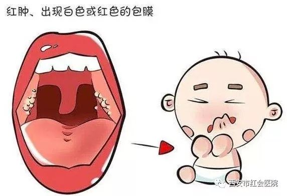 孩子扁桃体老发炎该怎么办?家长们看过来!