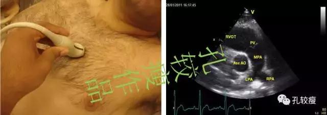 超声心动图 存档