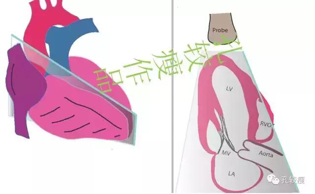超声心动图 存档