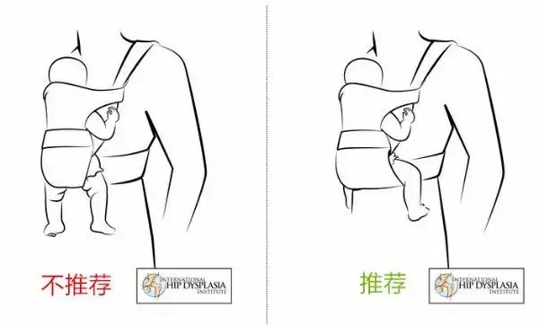                     赶紧自查！这个病等宝宝会走路才发现就晚了！