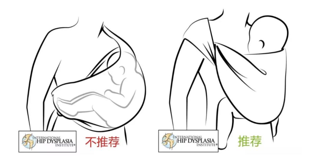                     赶紧自查！这个病等宝宝会走路才发现就晚了！
