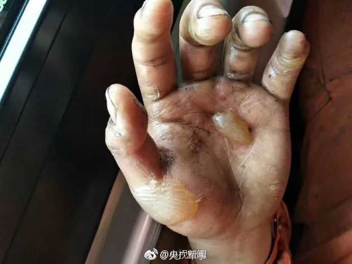 看完这样的双手,再铁石心肠的人都哭了…… 久久精品视频在线观看232