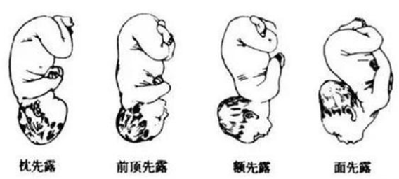 25134535c2054a369788cba2511440ee.png