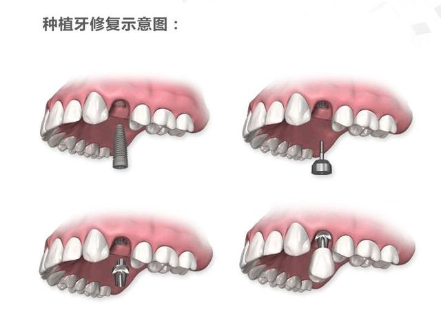 不什么言状成语_成语故事图片(2)