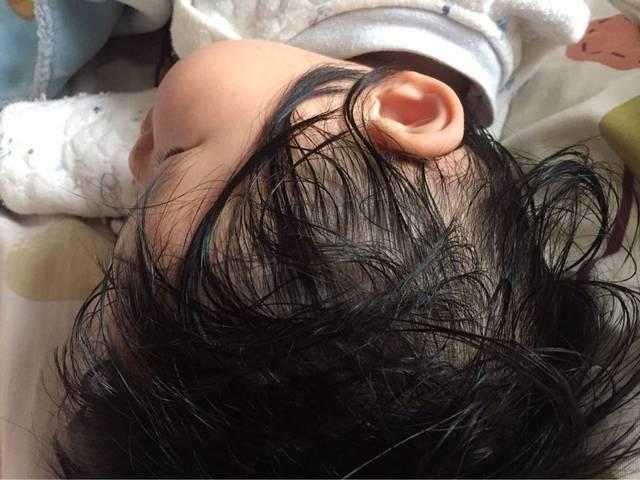                     警惕：孩子脾虚、积食，睡觉会出现5种表现！家长要及时调理