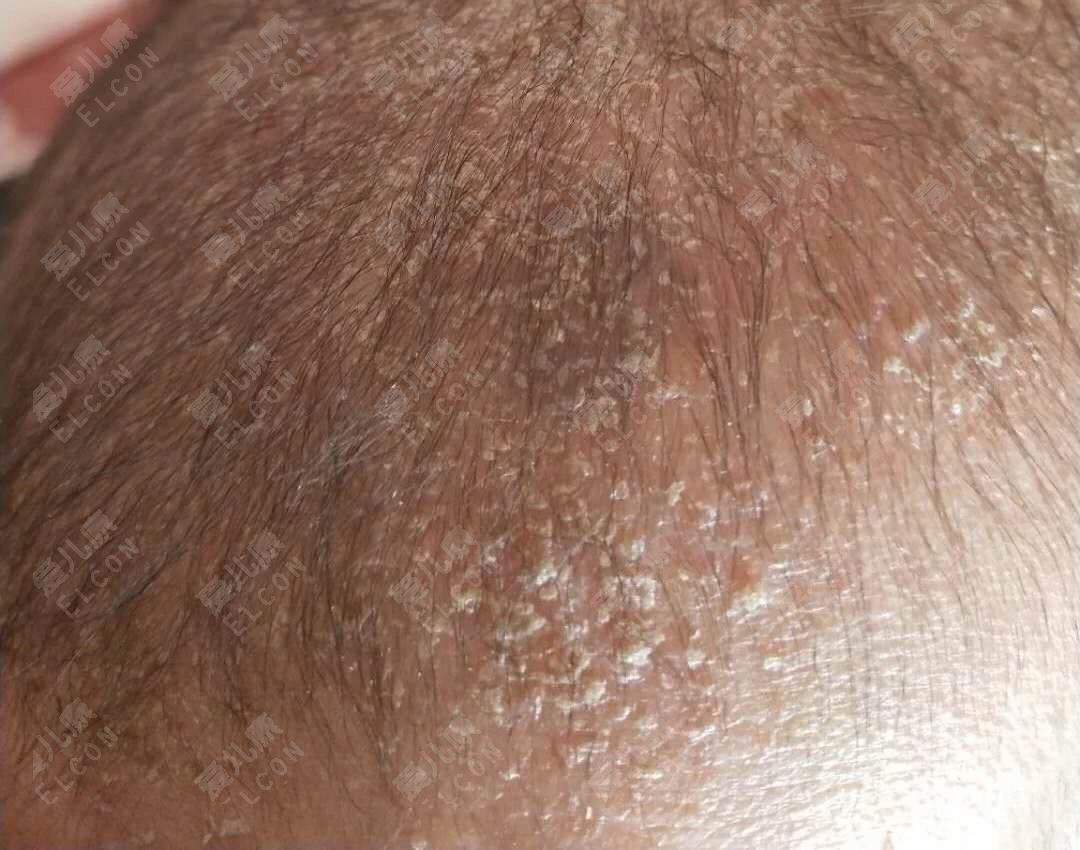 宝宝喜欢“夹腿”是污还是病?这下该轮到家长尴尬了…