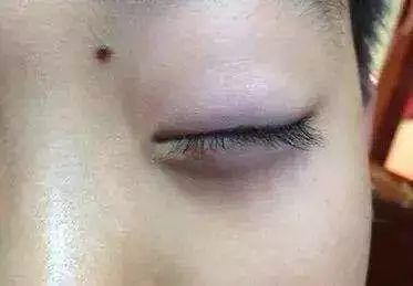                     孩子脾胃怎么样？不看舌苔，眼袋颜色也能告诉你！