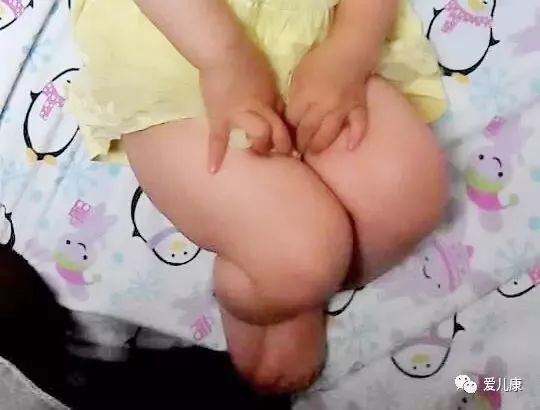 宝宝喜欢“夹腿”是污还是病?这下该轮到家长尴尬了…