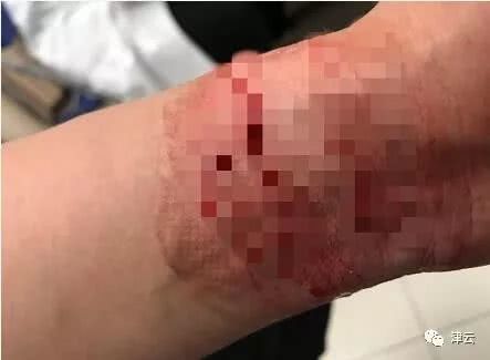 起底自然阳光：曾被央视曝光变相传销 有人割腕自杀(图1)