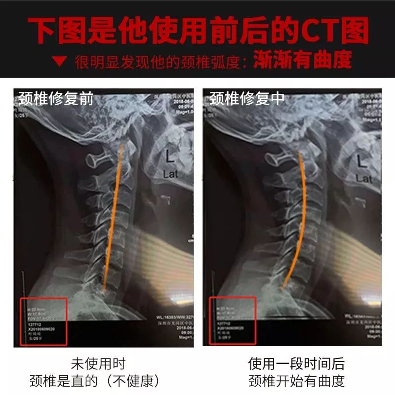 颈肩酸痛睡不安稳?用这一物,通经络,祛湿寒,3天见 效!