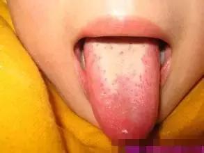                     风寒咳嗽和风热咳嗽，冰糖煮一碗水，润肺止咳，3天除根止咳！