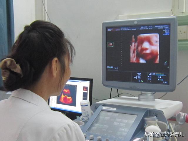                     为什么有的人做四维彩超看不到胎儿的五官？