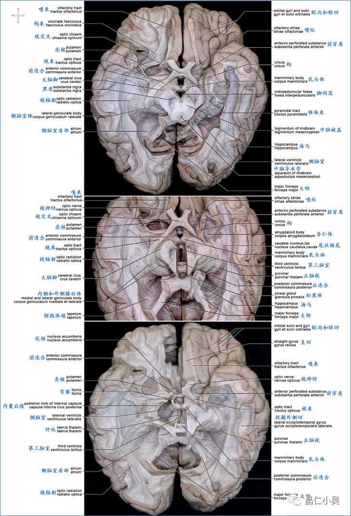 (一)大脑皮质显微解剖: 1 ,大脑皮质结构cerebral cortex structure