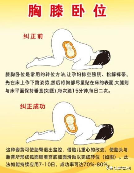 什么时候调整胎位 961aa07b67ff4dfc91cbeae99ee79195.jpeg