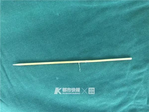                     触目惊心！3岁男孩被竹签从嘴巴直插脑干！这东西很多孩子爱吃！