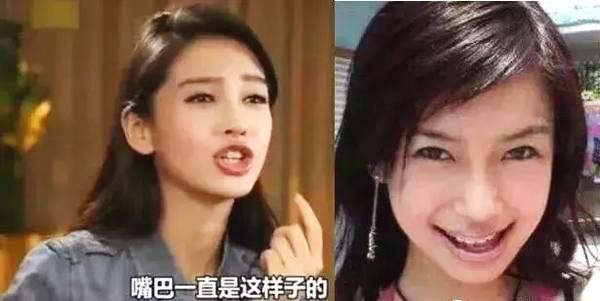 整牙如整容,那些整牙前后判若两人的明星们:大变脸简直不敢认! 明升88官方网站