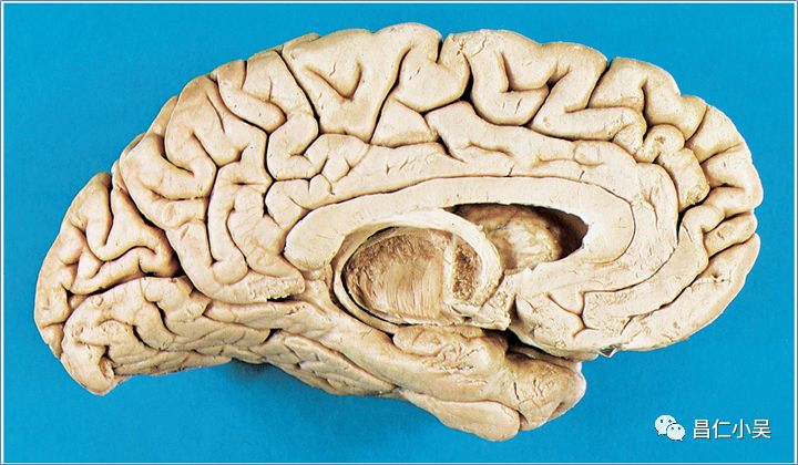 (一)表面解剖surface anatomy一,灰质,白质,脑室解剖:四,断层解剖(二)