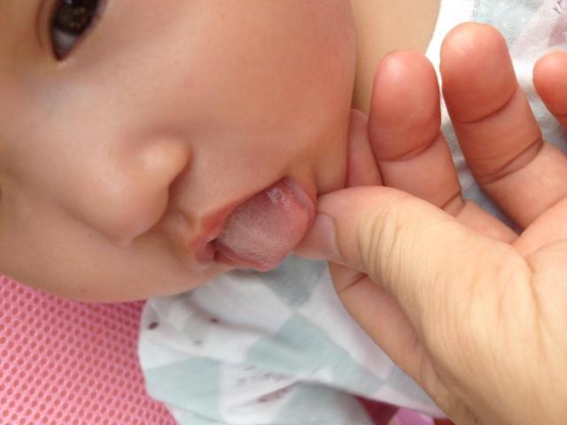                     提醒家长：孩子这5个小毛病，说明积食了！家长别大意