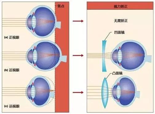 远视储备没有了怎么办