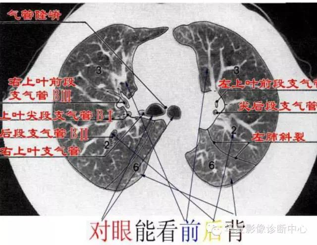 超全胸部ct读片 解剖,太实用了