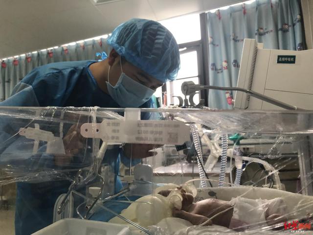                     早产龙凤胎只有成人巴掌大 连下9道病危通知书被成功救活