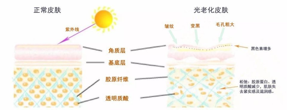 皮肤为什么会衰老都有哪些表现