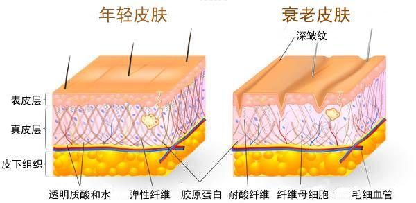 皮肤为什么会衰老都有哪些表现