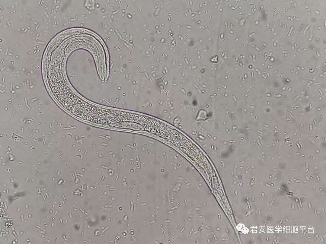 绝版推送震撼来袭一文看尽粪类圆线虫前世今生